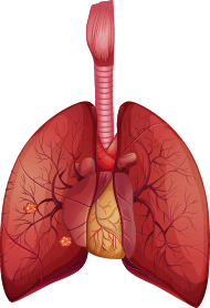 adenocarcinoma