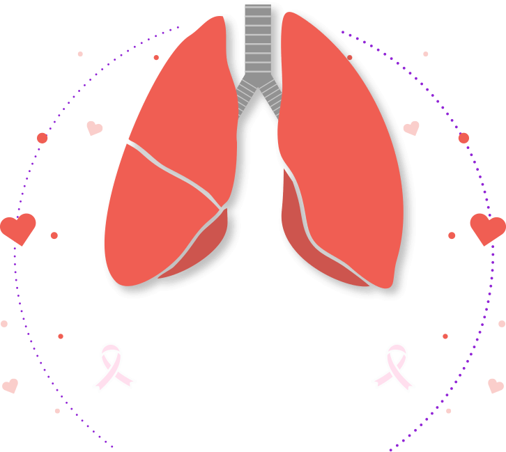 lung-cancer-1